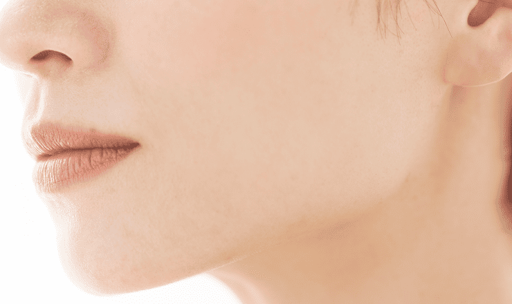 韓国式の糸リフト