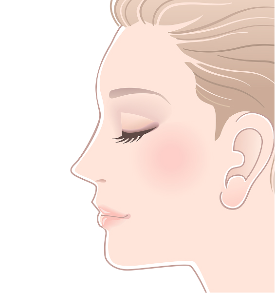 ヒアルロン酸注入あり