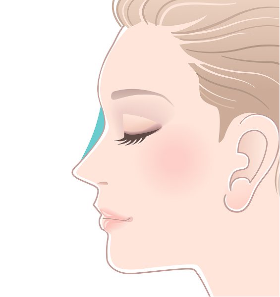 ヒアルロン酸注入なし