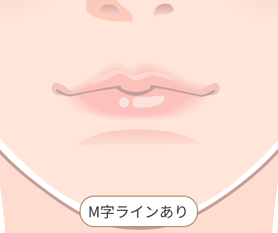 唇 M字ラインあり