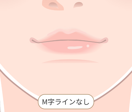 唇 M字ラインなし