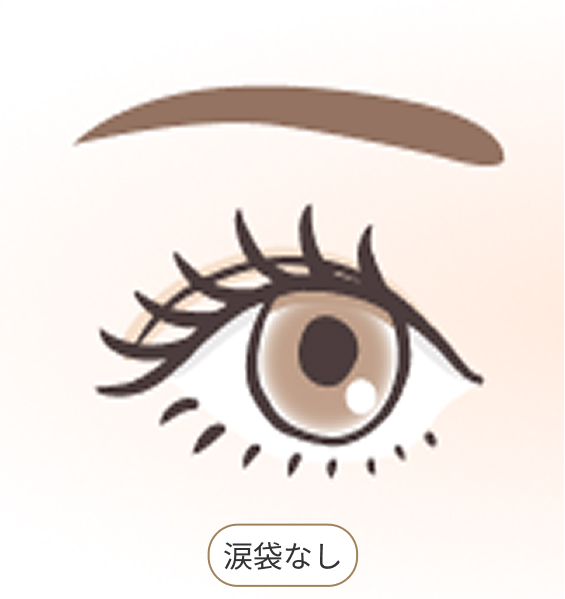 涙袋なし