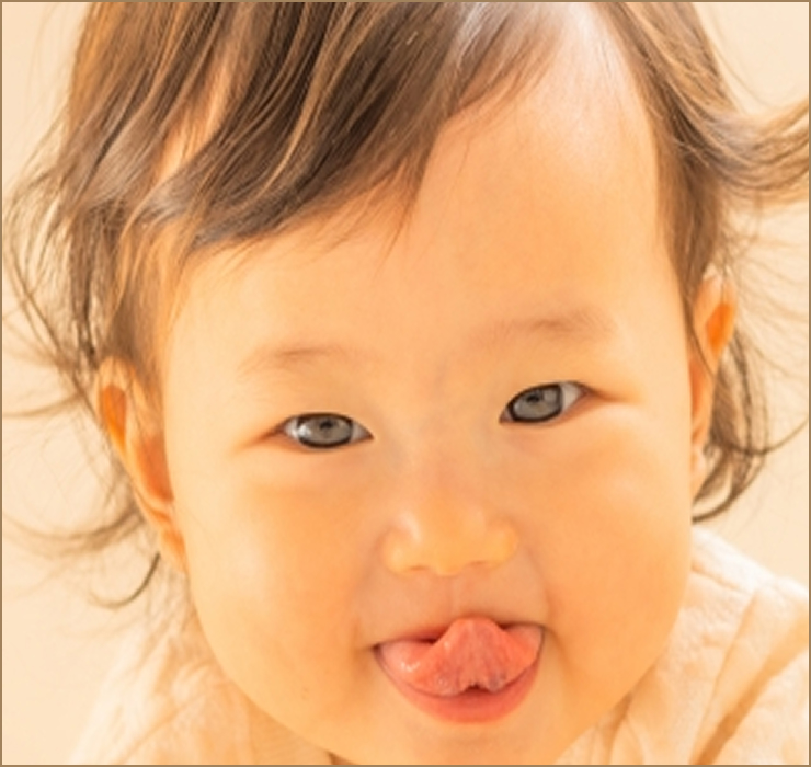 舌癒着症の特徴